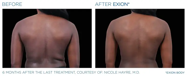 EXION result 7